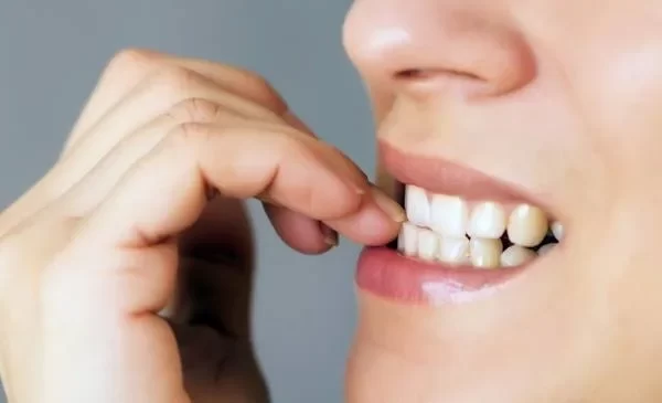 Onicofagia, perché fa male ai denti?